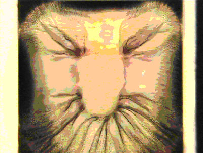 Most Bizarre Micrograph