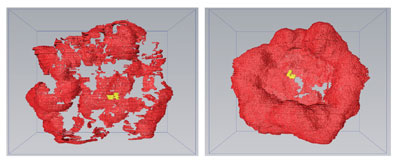 Comparison of 3D models of the nuclear envelope reconstructed from correlative light and electron microscopy images