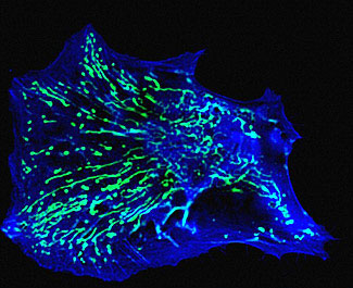 Confocal micrograph of a primary human fibroblast cell grown in culture stained blue for actin