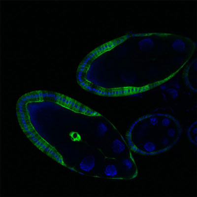 luorescence image of ovarian tissue of the fruit fly