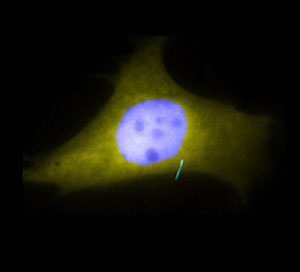 A cilium stands out in blue fluorescence against the yellow fluorescence of the rest of the cell