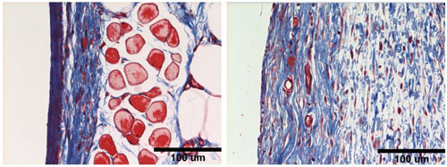 differences in collagen build-up in two tissue samples