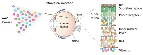 gene therapy for the eye