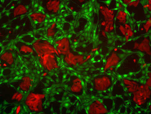 human breast cancer cells (red) grown together with mouse fibroblasts (green)
