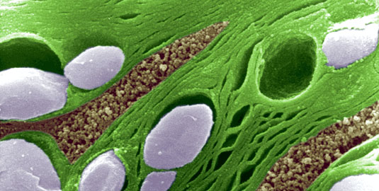 Scanning electron microscopy micrograph of a chloroplast in maize