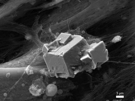 Artificial bone, or mineralization of the extracellular matrix