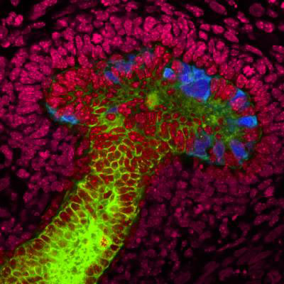human stem cells grown into early-stage ureteric buds