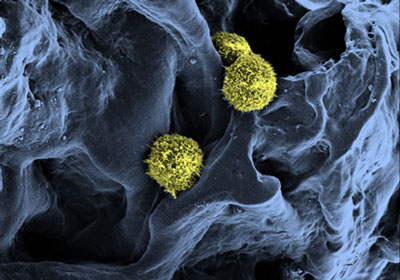 Scanning electron microscopy of stem cells (yellow / green) in a scaffold structure (blue)