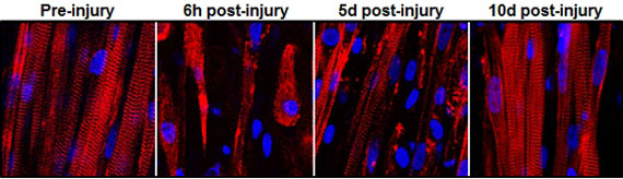 destruction and subsequent recovery of engineered muscle fibers
