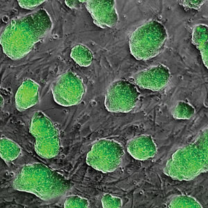 pluripotent stem cells