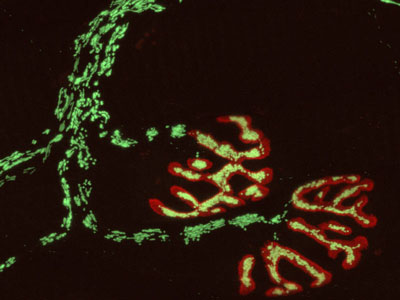 peripheral nerve, with the neuromuscular endplates stained in red