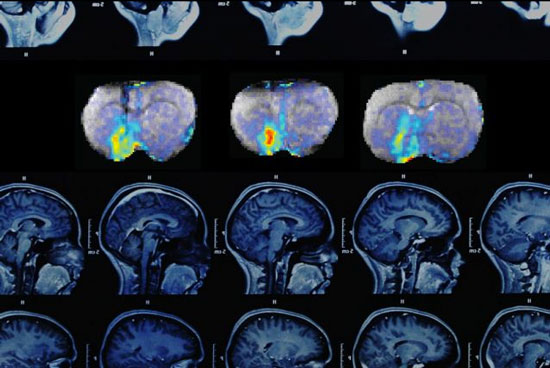 MRI images (top row) shows how dopamine concentrations change over time in the brain