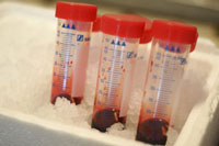 blood vials