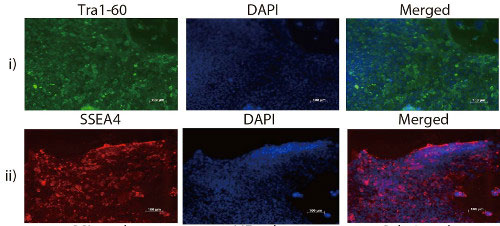 Fluorescence images of immunostained human iPSCs