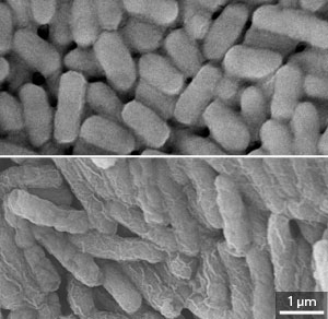 Scanning electron microscopy images of Escherichia coli