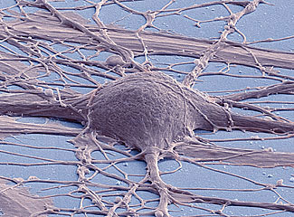 Scanning electron micrograph of cultured human neuron from induced pluripotent stem cell