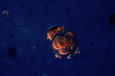 Four-cell human embryo