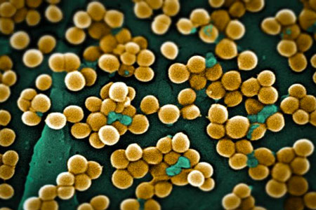 methicillin-resistant Staphylococcus aureus bacteria