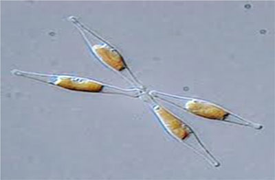 Microscopical picture of a diatom (Phaeodactylum-tricornutum)