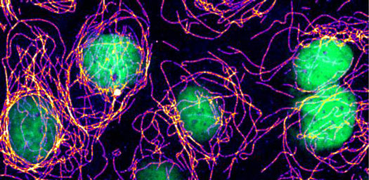 Cells with damage in their DNA (green) assemble abnormally stable microtubule structures (purple to white)