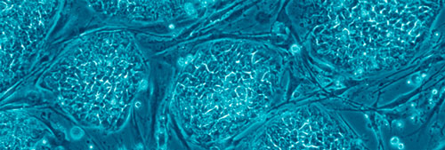 Human embryonic stem cells