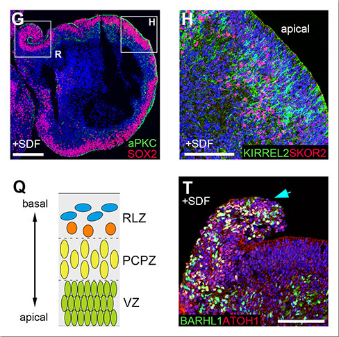 ontinuous neuroepithelium and laminar structure induced by SDF1