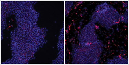 In these images, the ability of the new Cas9 approach to differentiate stem cells into brain neuron cells is visible