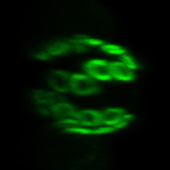 Image of an aged yeast cell