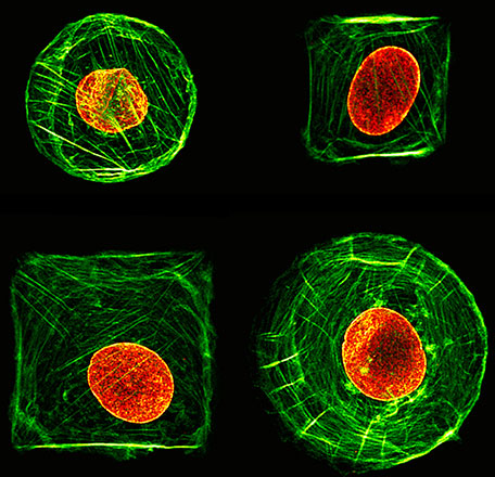 Confocal microscopy images of fibroblast cells of connective tissue