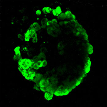 A pancreatic islet stained with the fluorescent dye, Two Photon-alpha