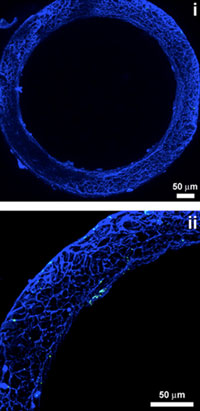 Image of a blue stained circular bone marrow