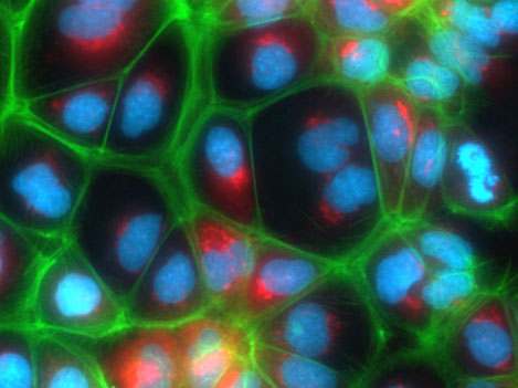 Fluorescently labeled polarized Upcyte hepatocytes