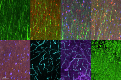 >Labeling different proteins in a single tissue sample