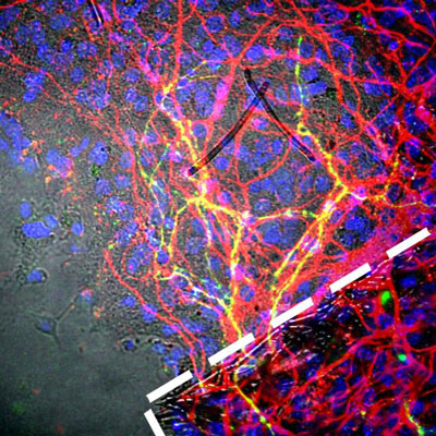 human neurons grown on 3-D scaffolds