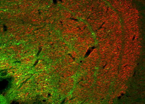 Konio neurons (green) in the lateral geniculate nucleus