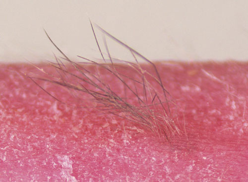Stem-cell-derived skin and hair follicles transplanted onto the back of a mouse