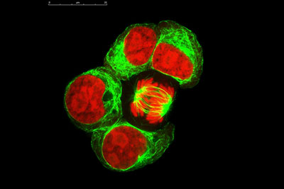 mitotic cells