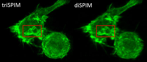 Immune cell labeled with green fluorescent protein