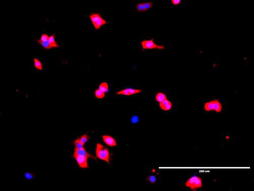 The iCas protein (stained in red) is shown moving into the cells’ nuclei