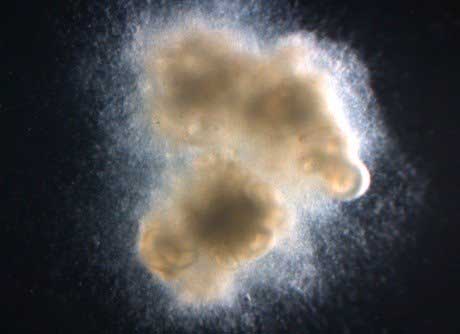 complex tissue-engineered human intestinal organoids with enteric (intestinal) nerves generated in a petri dish