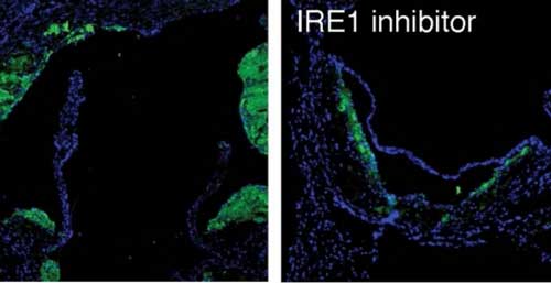 These images show a reduction in the number of macrophages infiltrating atherosclerotic plaques (in green) in animals treated with the IRE1 inhibitor