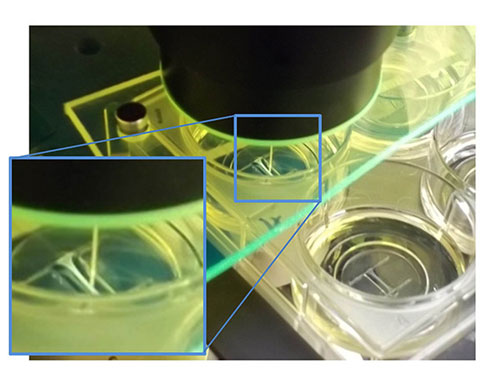 I-Wire device with cardiac fiber shown in magnification window