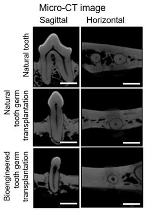 Micro-CT images of the canine natural tooth group (top), natural tooth germ transplantation group (middle), and bioengineered tooth germ transplantation group (bottom)