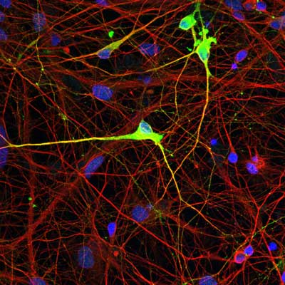 Neurons