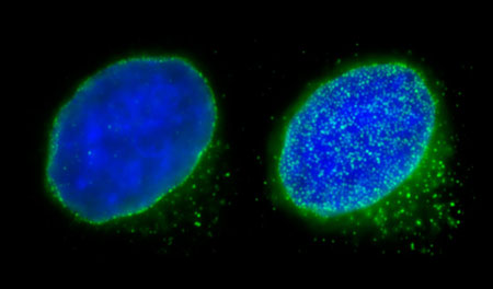 Fluorescence microscopy images of nuclear pore complexes (shown in green; blue region is DNA) on nuclear surfaces