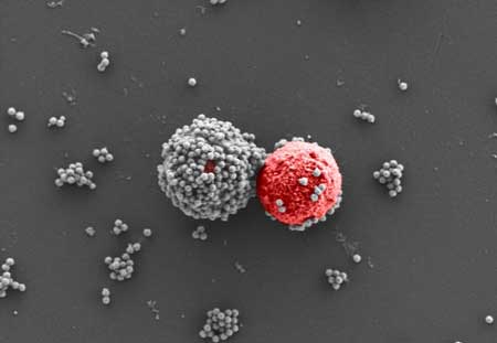 FcMBL-coated beads (gray) are able to bind to tumor cells (red)