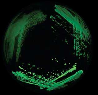 cellular sensor for protein aggregation produces fluorescent signals