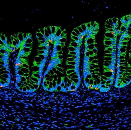 Differentiating Human Intestinal Organoids