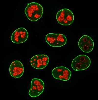 Secondary nanobodies coupled to fluorescent dyes