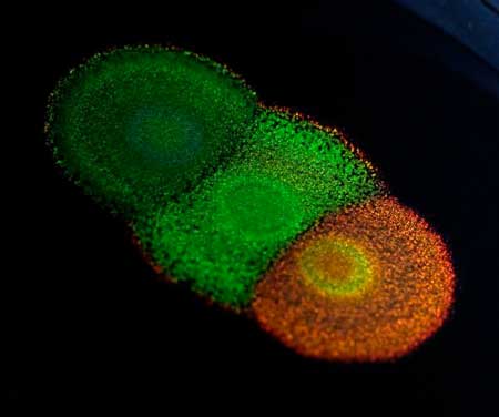 Flavobacterium